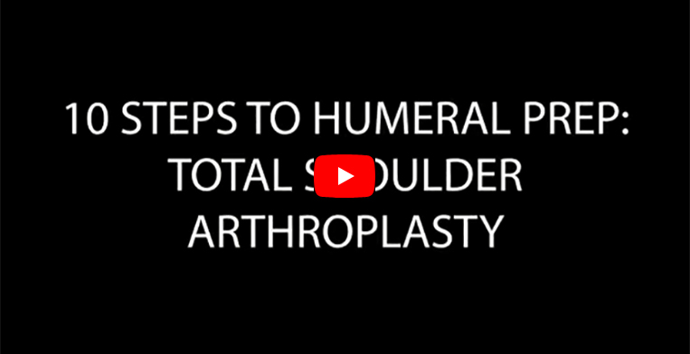 Humeral Preparation Video